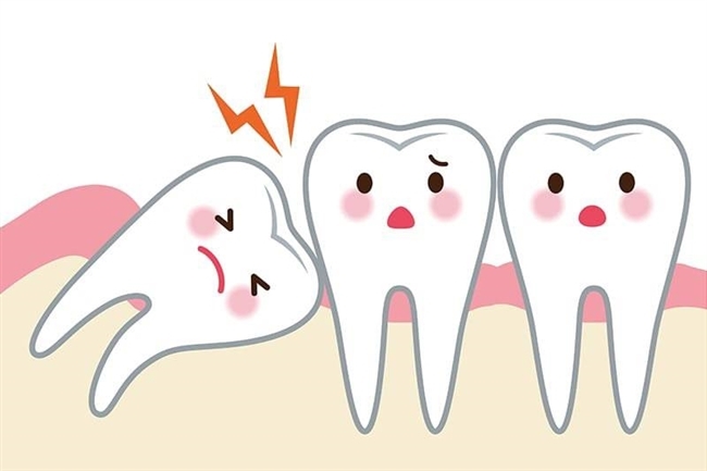 深圳睇牙介紹？邊種智慧齒唔可以拔除？
