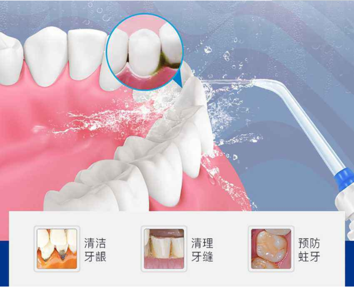 深圳維港洗牙