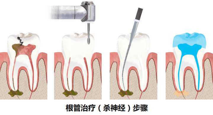 二次杜牙根