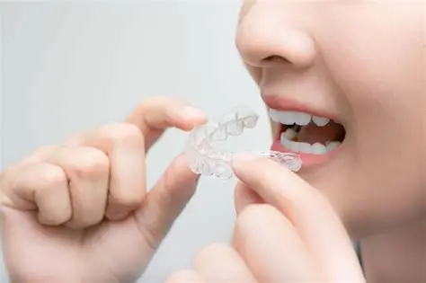 隱形牙套