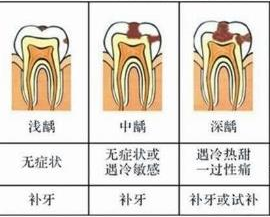 維港口腔補牙墊底