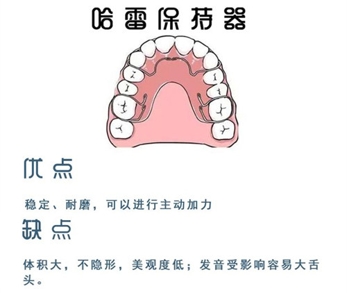 哈雷保持器