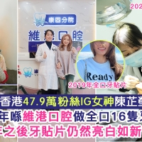 維港口腔牙科做牙貼面點解咁多IG博主推介？香港人去又有咩優勢？
