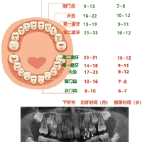 深圳維港口腔來維护孩子的牙齿健康