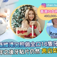 ​2026深圳牙貼片推介，北上深圳就選維港口腔