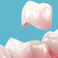 深圳做牙冠價錢？做牙冠嘅流程係點樣嘅？