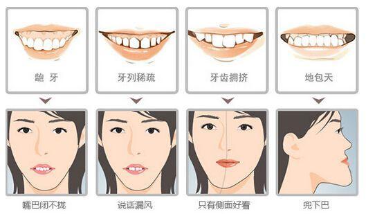 錯頜畸形矯正前應做哪些檢査和治療？