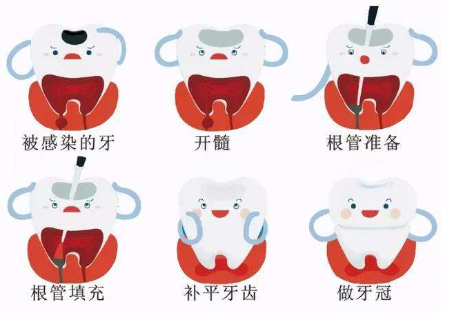 乳牙牙髓病和根尖周病的特點和危害
