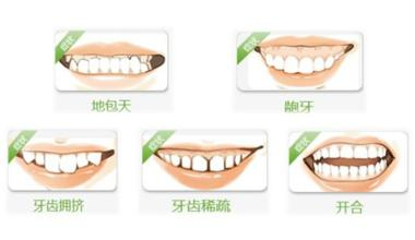 箍牙會容易導致牙根被吸收嗎？點避免？深圳箍牙推介