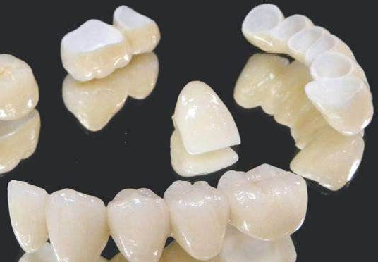 深圳嵌體/牙套收費價錢？嵌體與牙套有乜區别？