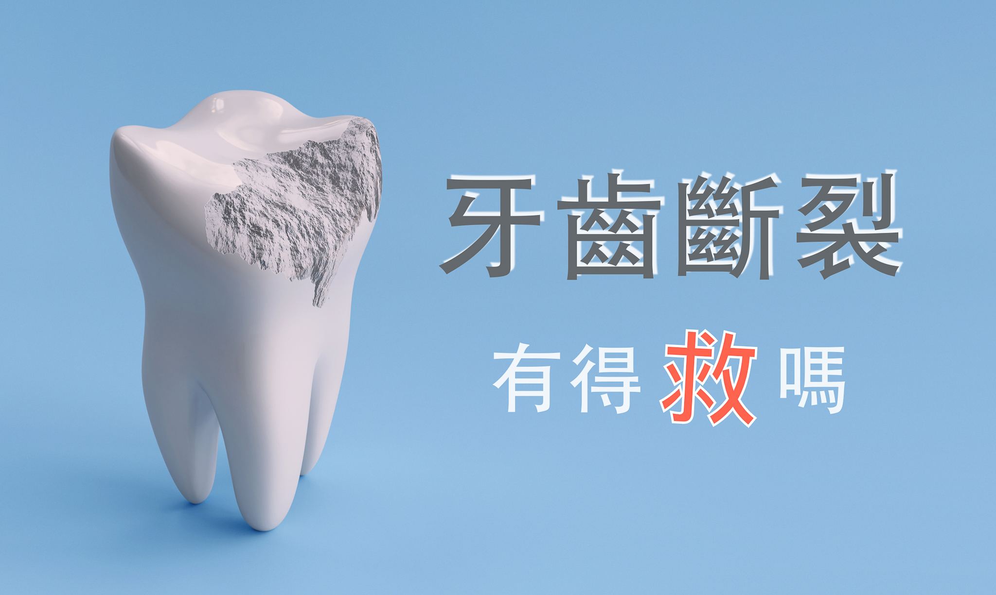 深圳睇牙介紹？如何判斷牙根斷裂是否需要拔牙？