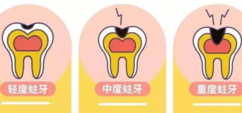 深圳睇牙選維港口腔，補牙修復更安心！