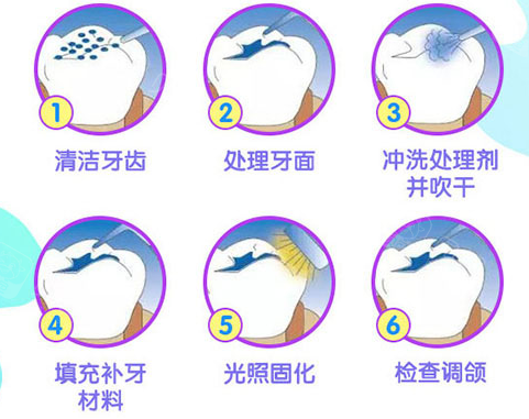 深圳牙科邊度好？深圳補牙有咩優勢？