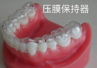 箍牙保持器
