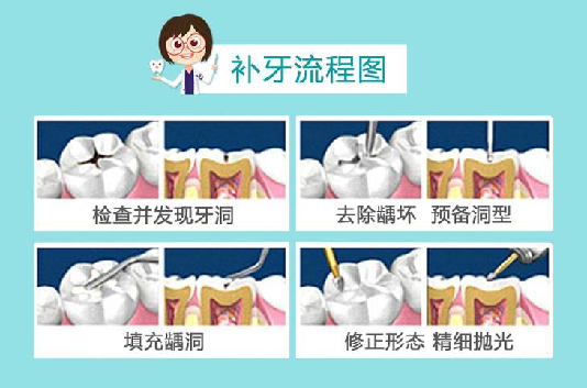 深圳維港口腔補牙流程