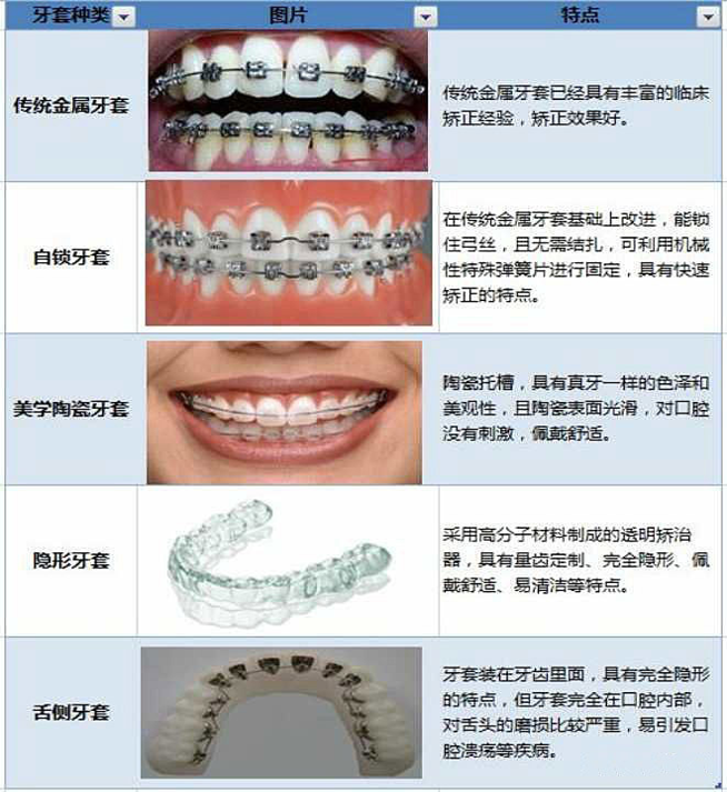深圳箍牙，牙套種類