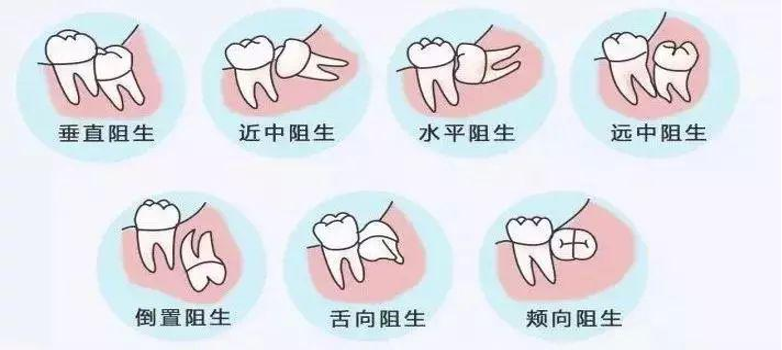 需要拔掉的