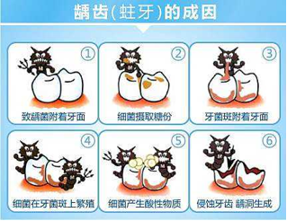 蛀牙的原因