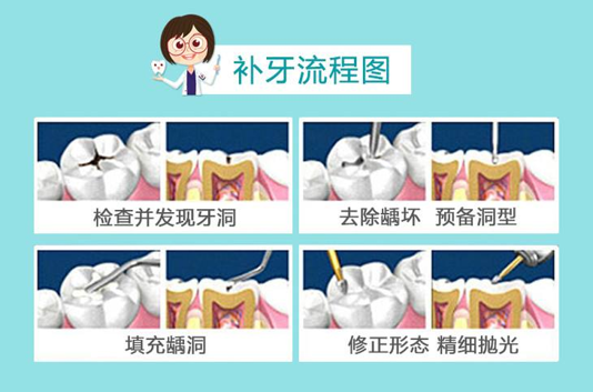 深圳補牙流程