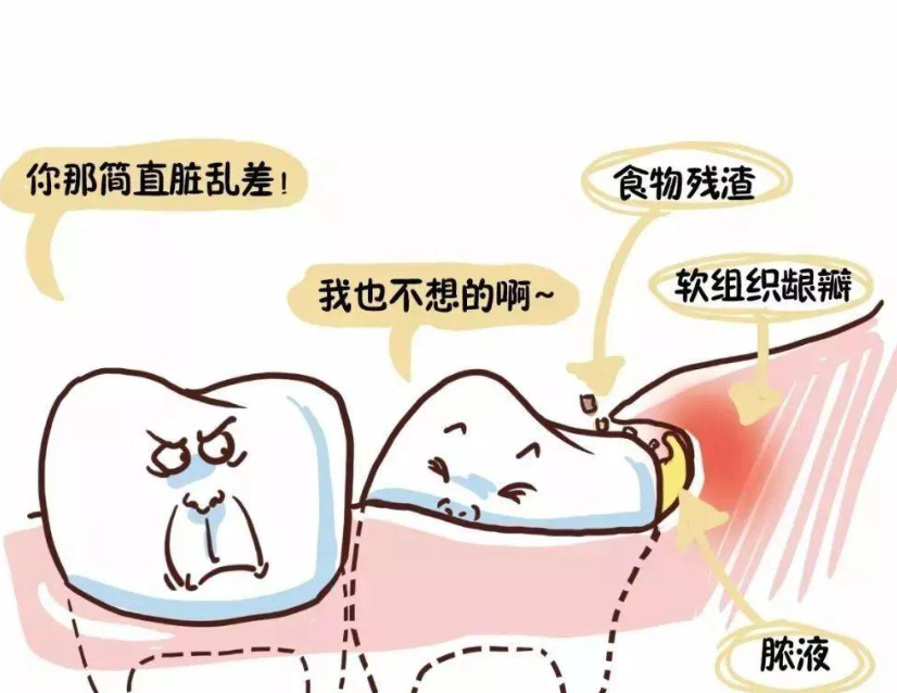 智齒清潔，維港口腔