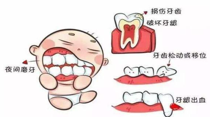 夜間磨牙