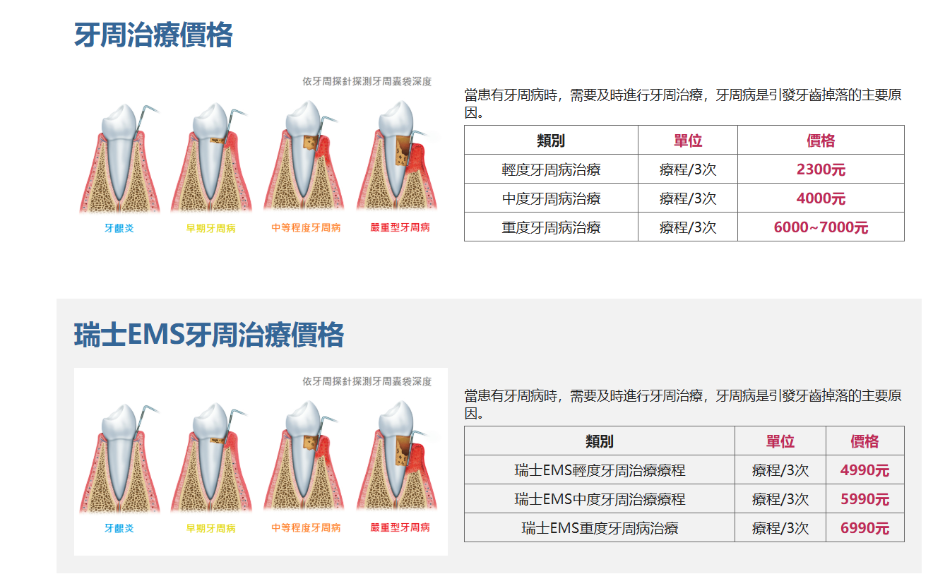 維港口腔牙周治療價錢
