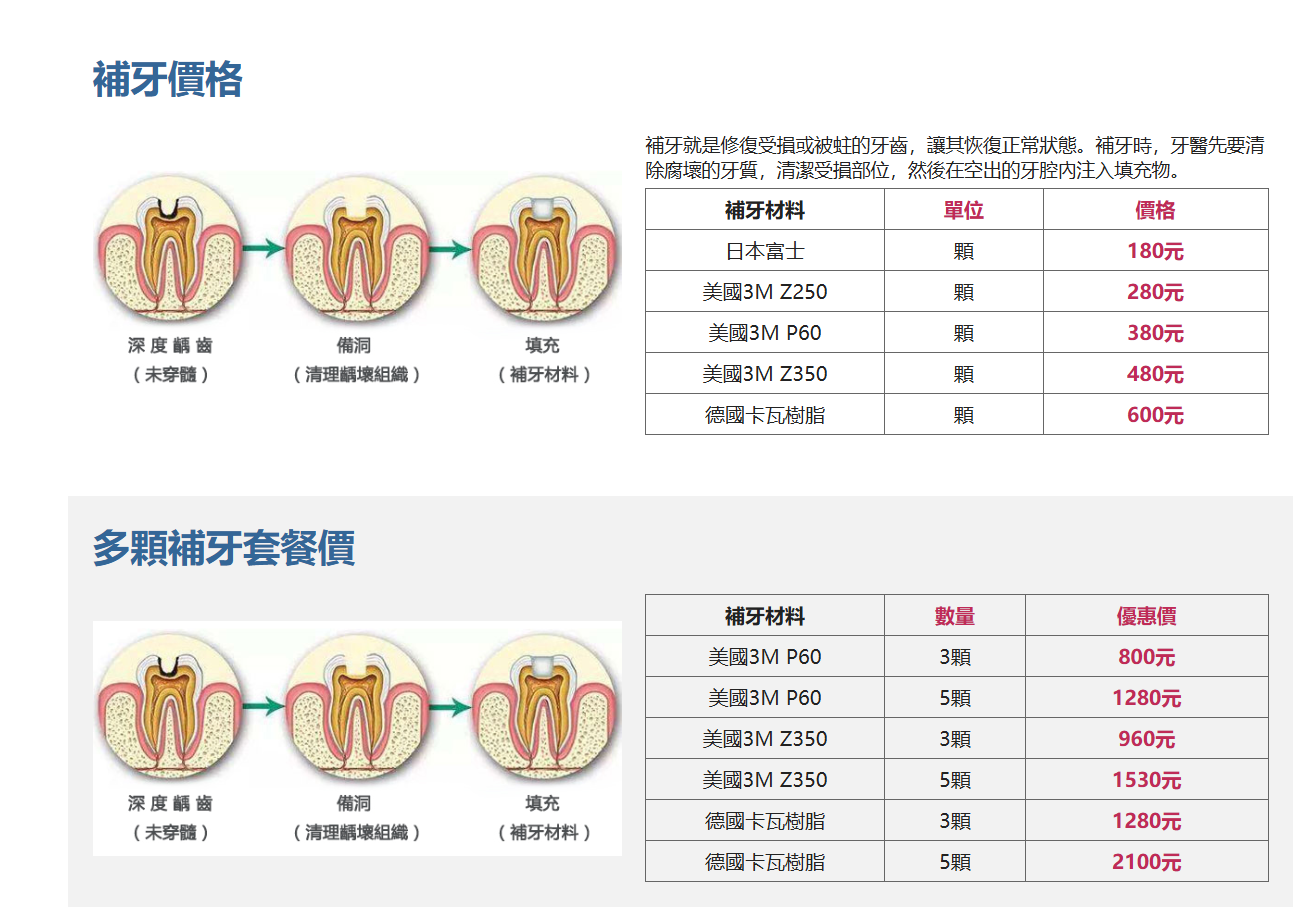 維港口腔補牙價格