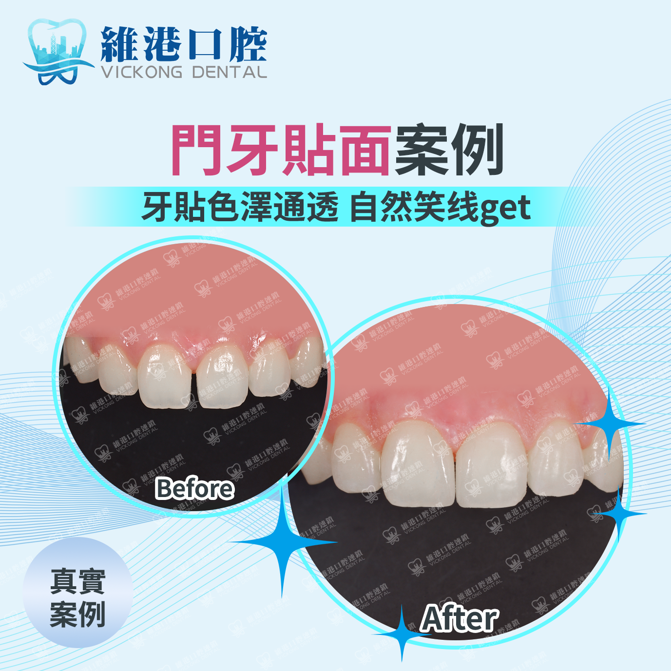 維港口腔