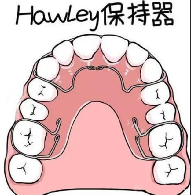 哈雷保持器