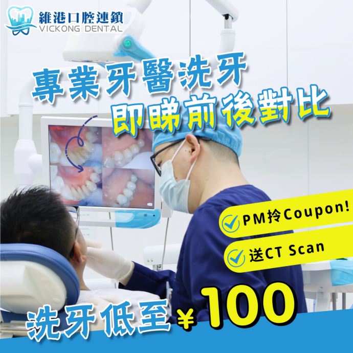 維港口腔洗牙前後對比