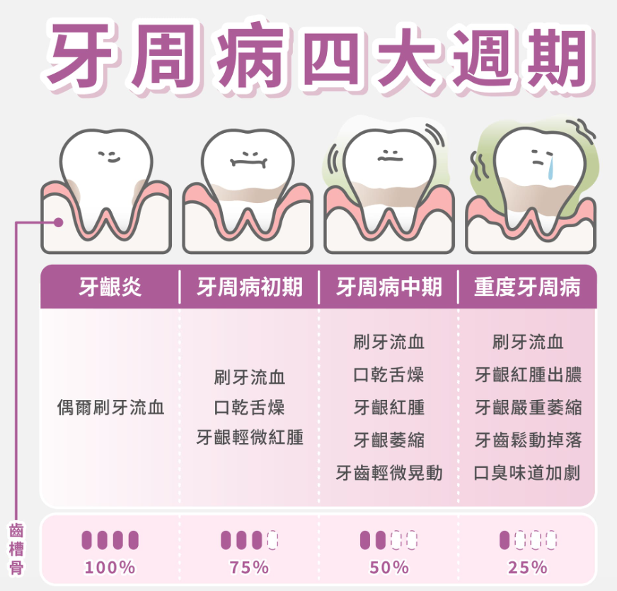 牙周病四大週期 牙周病四大週期