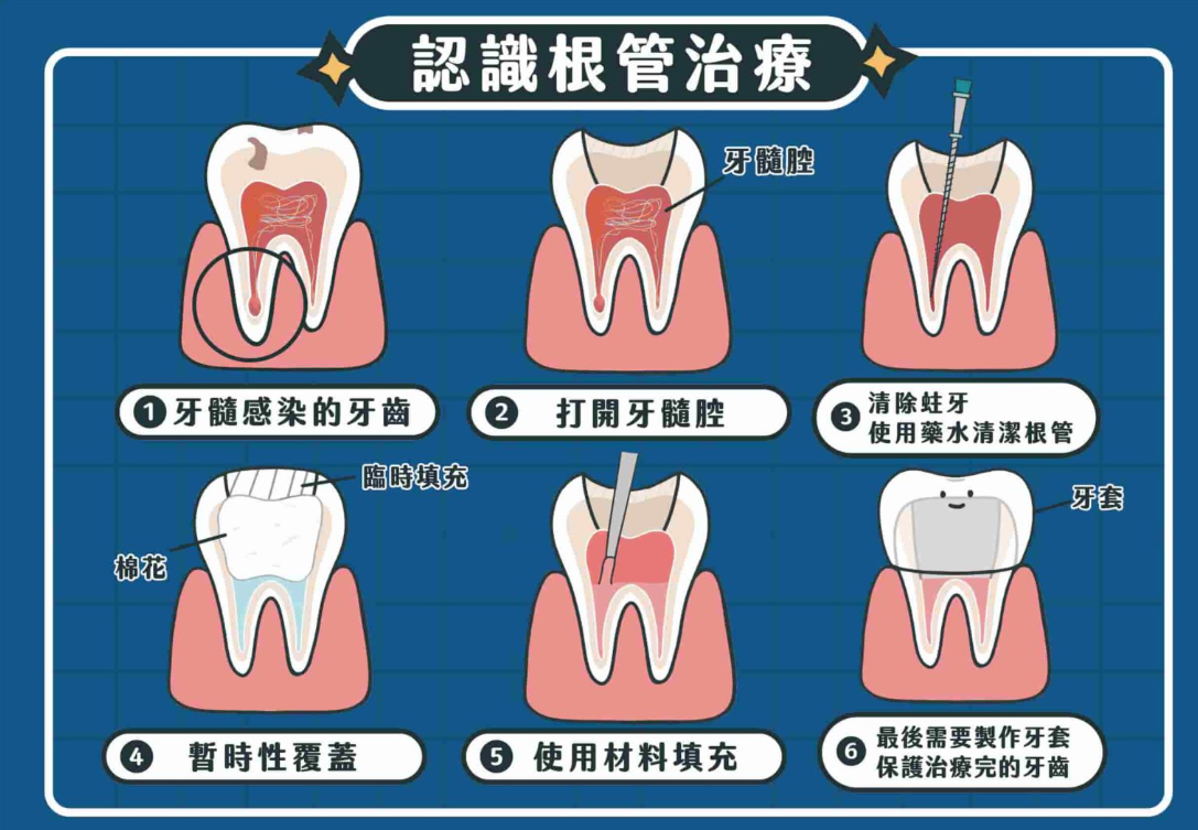 深圳杜牙根 深圳杜牙根