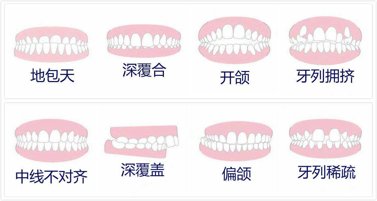 地包天
