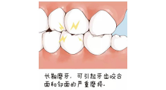 夜磨牙有什麼危害？