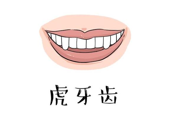 虎牙矯正