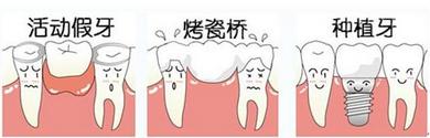 鑲牙